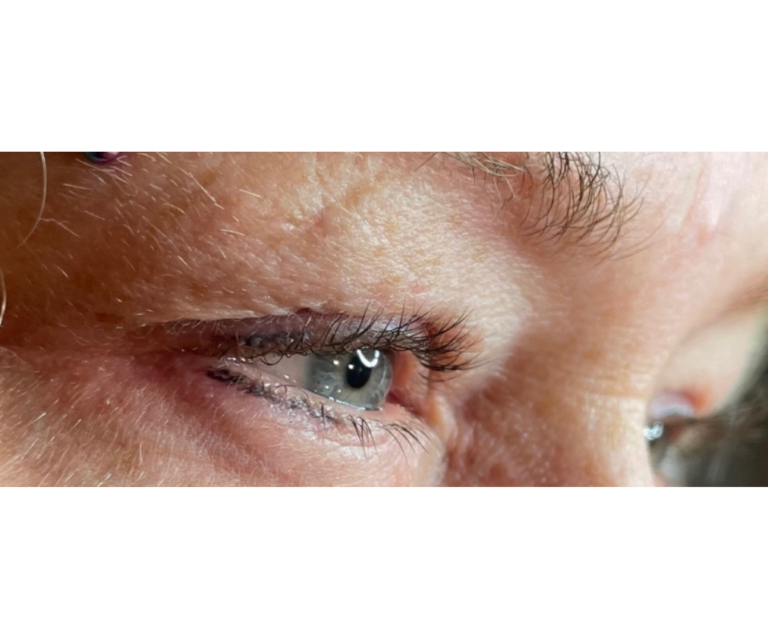 Before Image: Lash Lift - right-front-oblique