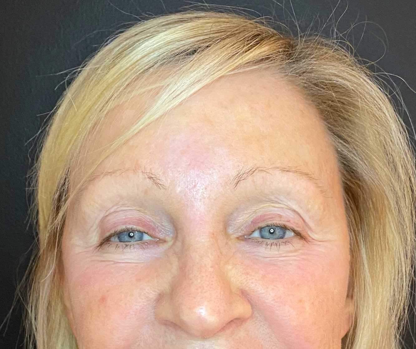 Before Image: Before and after, eyebrows and eyeliner - front