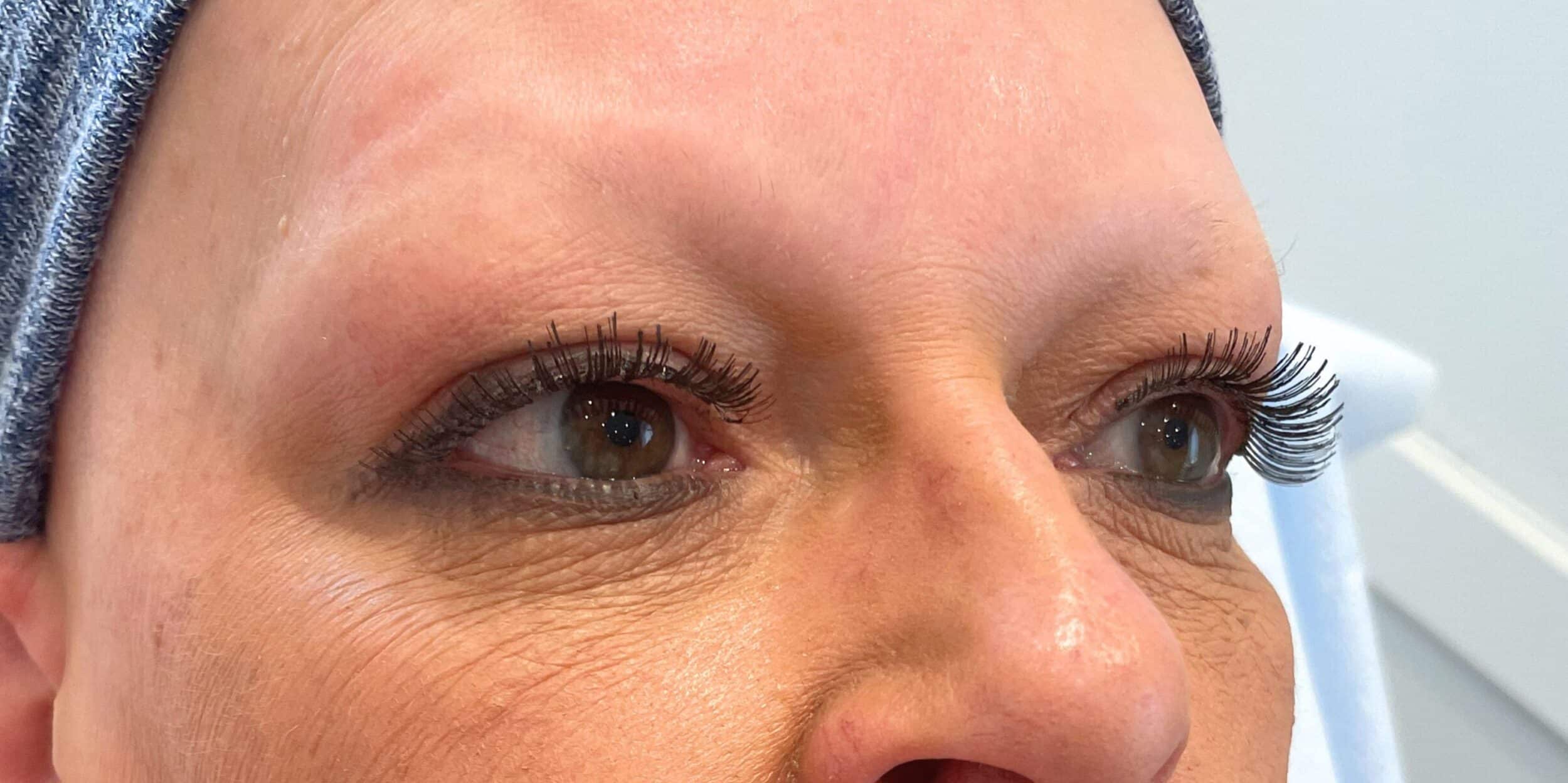 Before Image: Brows, fully healed - front