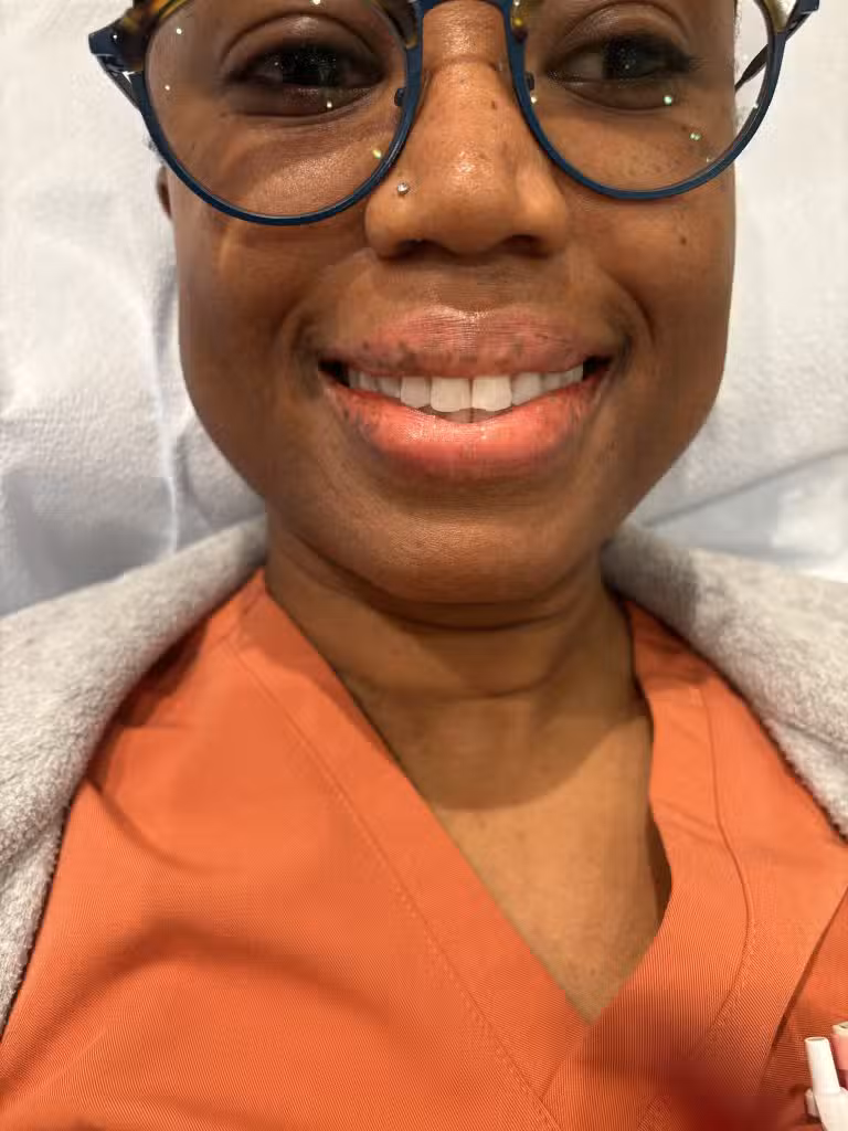 Before Image: Before and After Corrective Lip Blushing - front