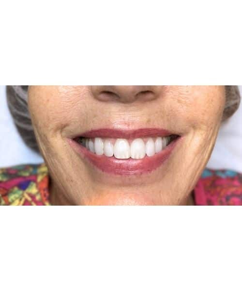 After Image: Full Lip Color - front