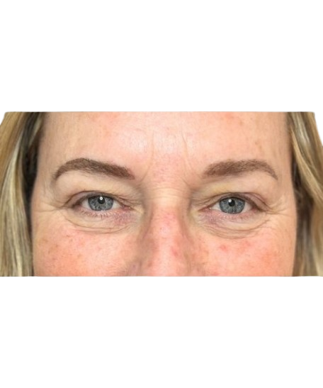After Image: Eyebrows - front